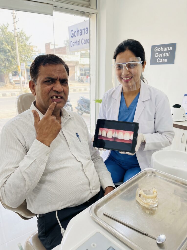 Can a Broken Tooth Become Normal Again?